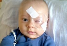 Internauci pomogli uzbierać pieniądze na operację oka 1,5-rocznego Kuby