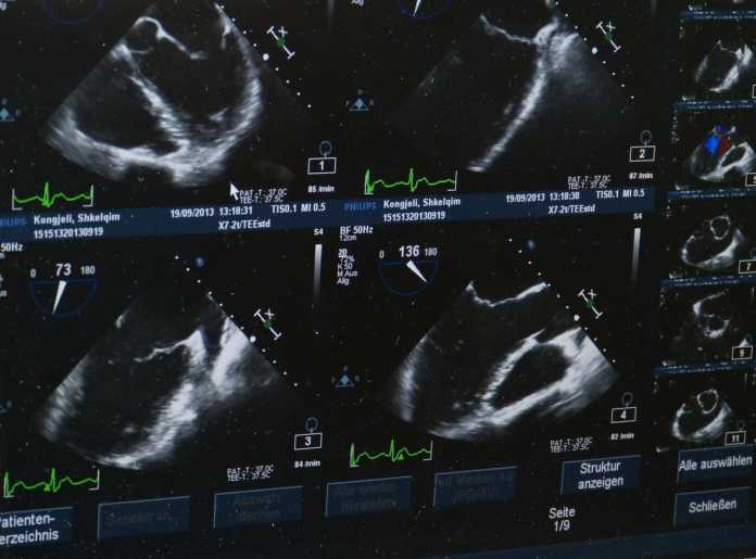 ultrasound-509396_1280