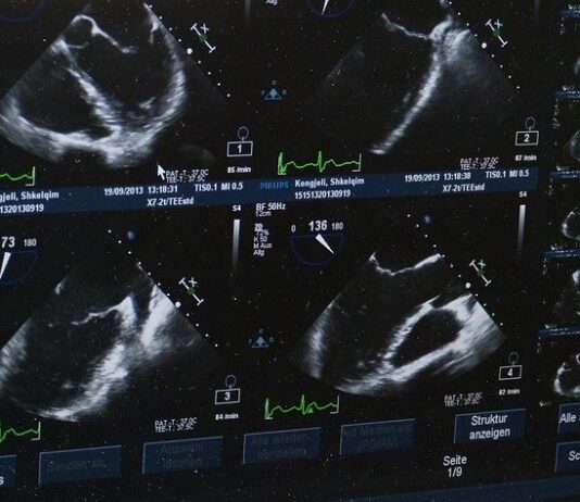 Bezpłatne badania USG dla dzieci i młodzieży. W KSW nr 2 w Rzeszowie