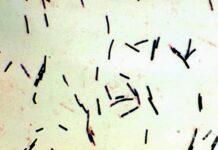 Bakteria kałowa w kranach na Podkarpaciu. Tysiące mieszkańców nie mogą pić wody