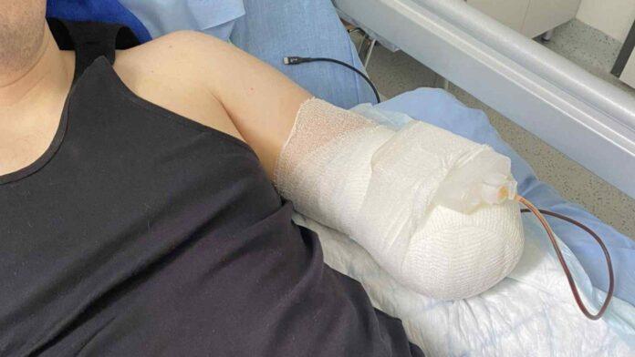 piotr-zbiorka-proteza