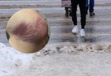 Recydywa na lodzie. Trzeci upadek mieszkańca Rzeszowa i “festiwal znieczulicy” w sieci