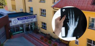 Zamieszanie ws. szpitala w Sędziszowie Małopolskim. Zwolnienia i pracownia RTG do likwidacji?