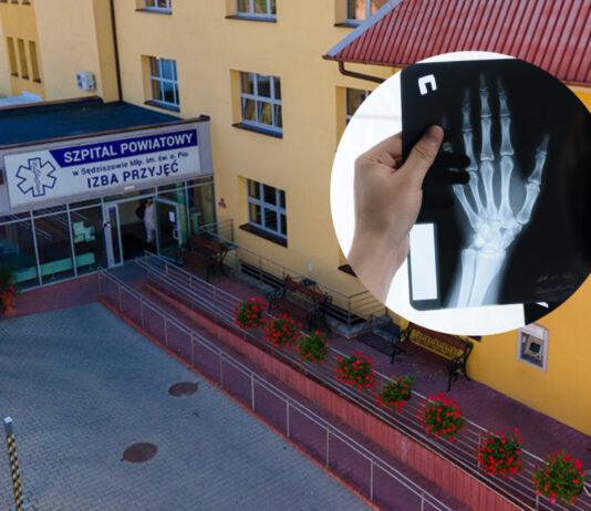 Zamieszanie ws. szpitala w Sędziszowie Małopolskim. Zwolnienia i pracownia RTG do likwidacji?