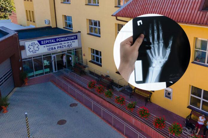 szpital-sedziszow-malopolski-rtg