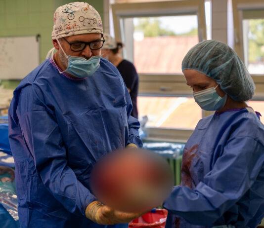 Pacjentka miała w brzuchu torbiel ważącą kilka kilogramów. Trudna operacja w USK w Rzeszowie